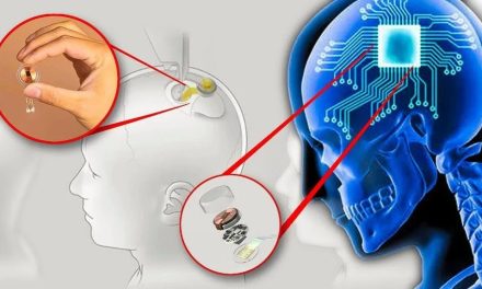 Neuralink Berhasil Tanam Chip Otak Kedua Atasi Kelumpuhan